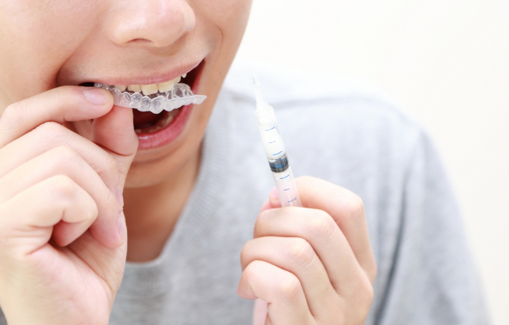 ホワイトニング