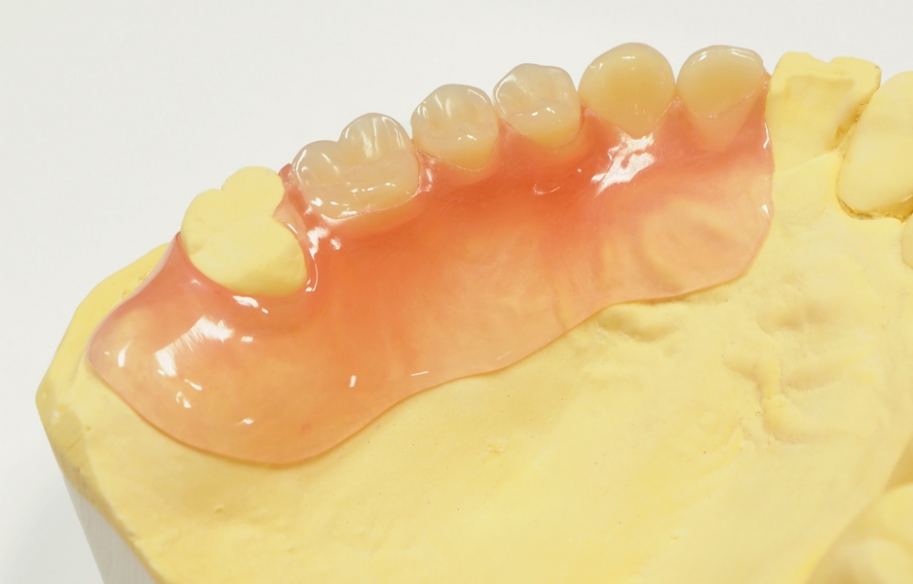 入れ歯選びの基準